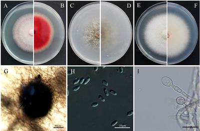 Characteristics of Epicoccum latusicollum as revealed by genomic and metabolic phenomic analysis, the causal agent of tobacco Epicoccus leaf spot